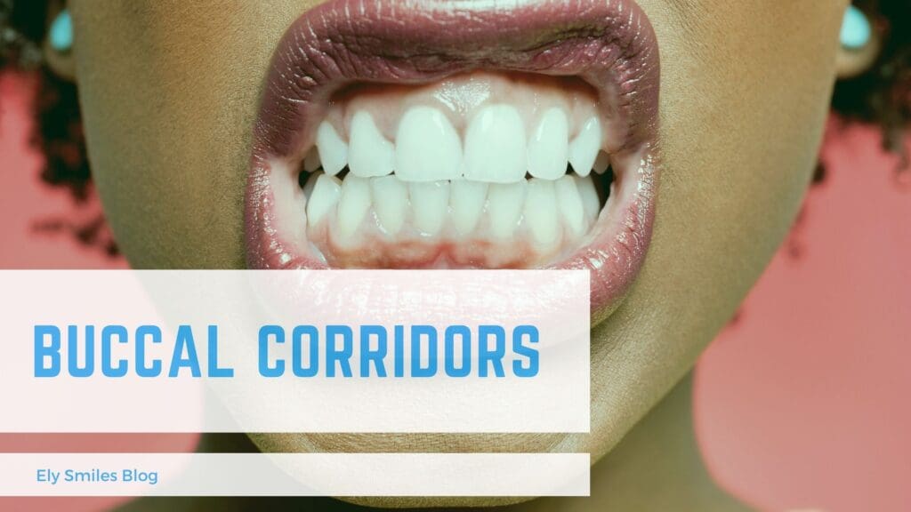 Buccal corridors