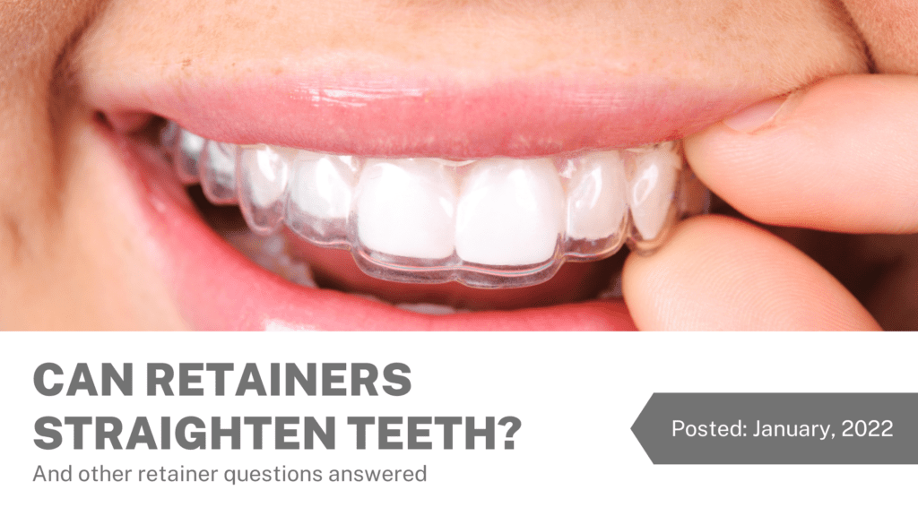 Can Retainers Straighten Teeth? -