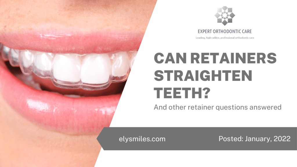 Can Retainers Straighten Teeth? - And Other Retainer Questions Answered