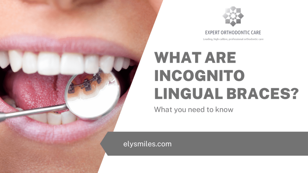 Lingual Braces London, Book A Consultation Today