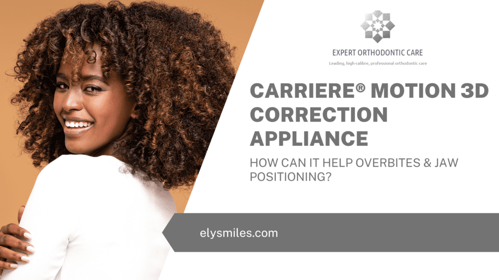 Carriere® Motion 3D Correction Appliance - How Can It Help Overbites & Jaw Positioning?
